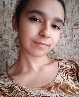 Albina